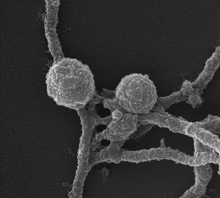 elektronimikroskopia biologiset näytteet